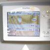 Never Used 2015 Cynosure SmartLipo MPX Body Sculpt NON-RFID Laser System