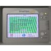 2008 Cynosure SmartLipo MPX 24 Watt Nd:Yag Laser System 1064nm 1320nm Facial Leg