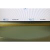 Palomar StarLux 300 IPL Star Lux ACNE Configured Lux V Redness Pigmented Lesions