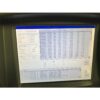 2016 Candela ALEX TriVantage QS Alexandrite NdYAG 755 1064 532 Tattoo Laser