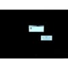 XLTEK Trex HD Natus Neurology Ambulatory EEG System Nanuk Sleep Monitoring Study