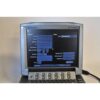 SonoSite M-Turbo Ultrasound System Leg Veins Portable MTurbo Sono Site 2010