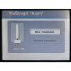 2014 Cutera truSculpt Tru Sculpt Radio Frequency RF Cosmetic Laser RF System