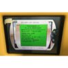 2013 Cynosure Smartlipo TriPlex SLT II CELLULAZE Laser SideLaze800 1440nm