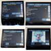 2016 BTl Exilis Ultra No Time Limit RF System Large and Small Power Handpieces