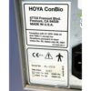 2007 Cynosure ConBio RevLite Q-Switched Nd:YAG Laser Tattoo Removal System