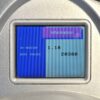 Syneron Candela 810 Diode Laser Comet DSL Matrix IR Fractional Wrinkle Treatment