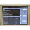 2011 Ulthera Ultherapy Non Invasive Ultrasound Therapy Neck Face Merz Aesthetics