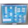 2004 Lumenis Lume One Lume1 LumeOne IPL with 2 handpieces