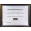 2009 Cynosure SmoothShapes Eleme Body Shaping Cellulite Reduction Smooth Shapes