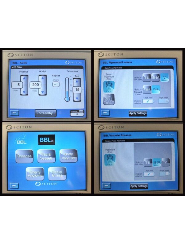 Sciton Profile BBLs Laser Broad Band Light Pigment Hair Removal Vascular Loaded