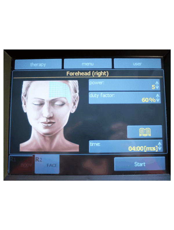 2011 BTL Exilis RF Wrinkle Tightening /w XP 2 & Large Handpieces