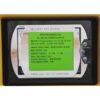 SmartLipo 2011 SLT II Triplex w Cellulaze Precision Cynosure Cosmetic Laser