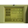 2002 Candela VBeam V Beam 1 Pulsed Dye 595 nm Vascular Acne Laser NEW DYE KIT