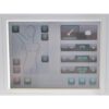 VenusConcept Venus Freeze MP2 Radiofrequency Body Contour Skin Tightening RF