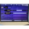 2009 Lumenis UltraPulse SurgiTouch Ultra Pulse 60W 225mJ CO2 Laser Encore DeepFX