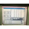 2007 Candela Alex TriVantage ATV 755 LPL 1064/532 Pigment Tattoo Removal Laser