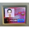 2017 Vivace Fractional RF Microneedling Wrinkle Skin Tightening Radio Frequency