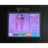 2011 Erchonia ZERONA Non-Invasive Cellulite Weight Loss Diode Contour Laser