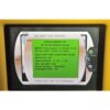2011 SmartLipo SLT II Cynosure Triplex Cellulaze Nd:YAG Laser Neck Body Palomar