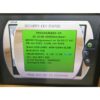 2014 Cynosure Palomar Triplex Smartlipo SLT II Cellulaze Laser System