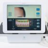 Syneron eMatrix Skin Rejuvenation Table Top Sublative RF System FG70441