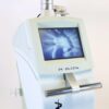 2012 Alma FemiLift 70W Pixel CO2 Laser System Vaginal Fractional Resurfacing