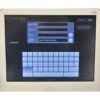 Merz Ulthera Ultherapy DeepSEE Ultrasound System w Access Key Accessories 2012