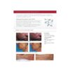 2008 Lutronic Surgical CO2 Laser eC02 Mosaic Skin Fractional Wrinkle Scar Lesion